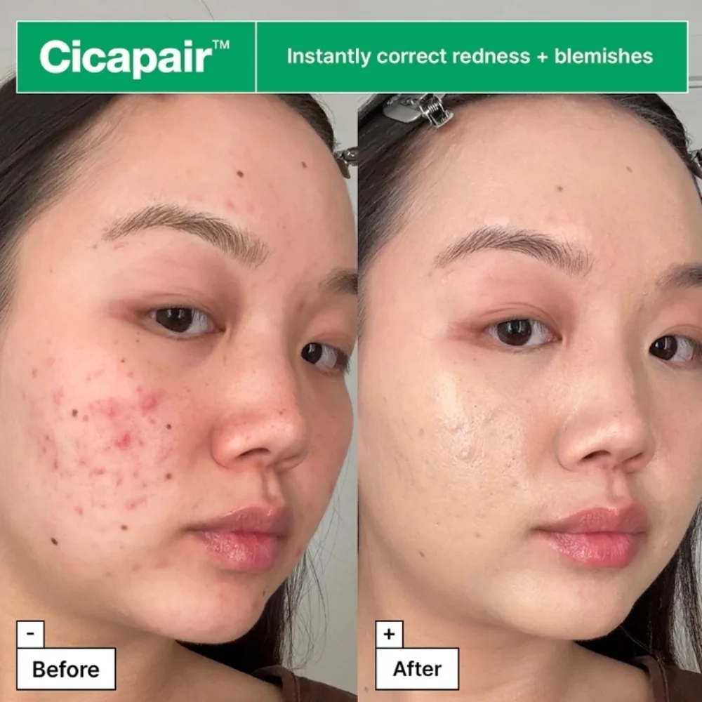 🔴 Dr.Jart+ Cicapair Tiger Grass Green Color Correcting Skincare Treatment Cream